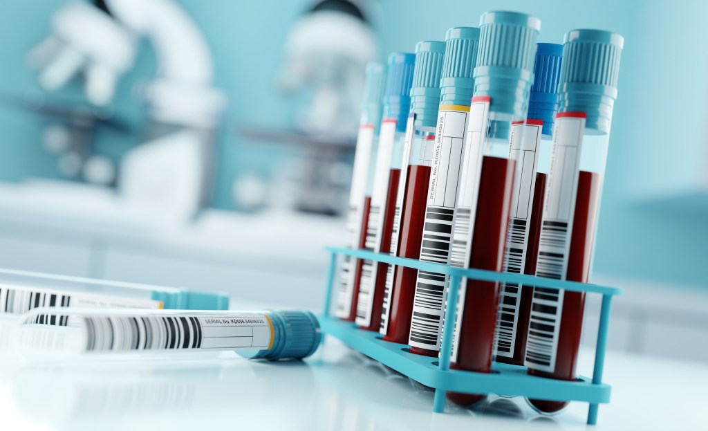 Blood samples and test results in a clinical medical laboratory. 3D illustration