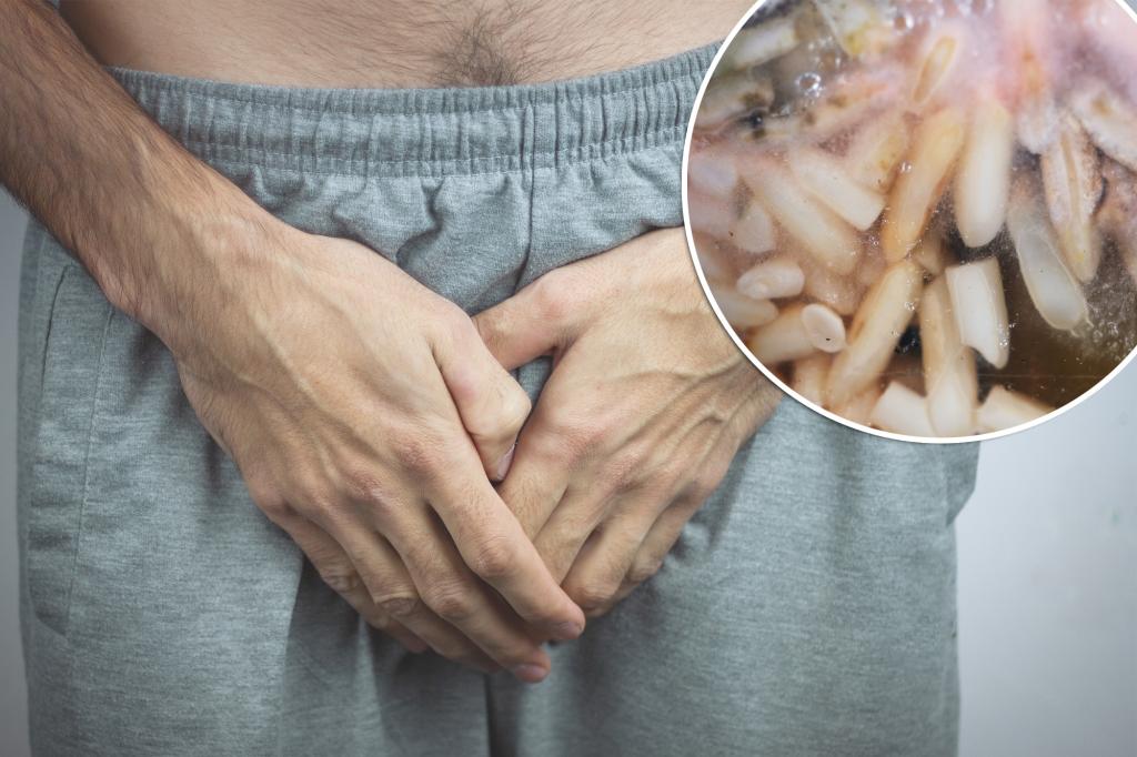 Man Gets Strange Penile Infection After Dinner, 'Strong' Sex