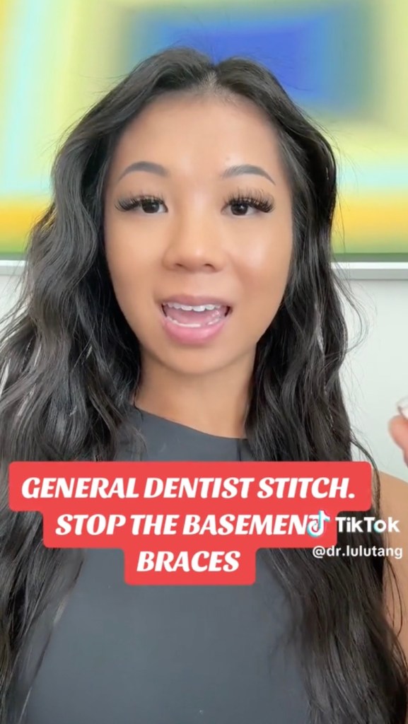 of "basement braces" the trend is when people who need dental work seek unlicensed or unqualified providers to avoid the expensive cost of oral appliances.