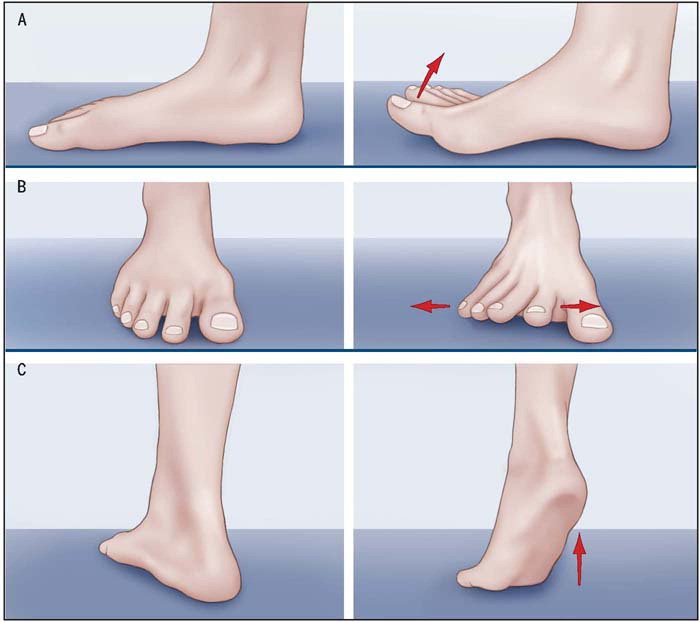 Illustrations of exercises described in the Journal of Orthopedic & Sports Physical Therapy that can also help with humps.