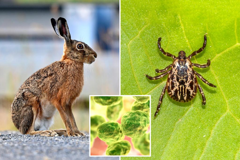 "Rabbit fever" cases rise in US as CDC warns of zoonotic bacterial disease